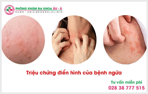 Thế nhưng chi phí xét nghiệm bệnh ngứa hết bao nhiêu? Chính là mối quan tâm  của rất nhiều người bệnh.