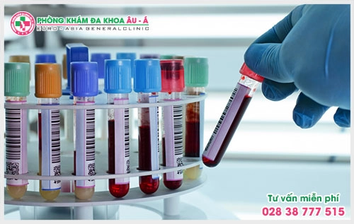 Nhiều người bệnh vẫn chưa đi khám vì còn lo lắng về chi phí xét nghiệm vảy nến hết bao nhiêu? Đây chính là điều mà rất nhiều người bệnh quan tâm.