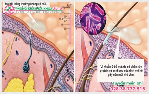 Việc nhận biết được các dấu hiệu bệnh hôi nách sẽ giúp mọi người có cách điều trị kịp thời căn bệnh này