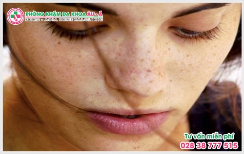 Em rất muốn đi khám nhưng không biết nên lựa chọn địa chỉ chữa bệnh nám ở TPHCM. Các bác sĩ có thể giúp em biết chính xác trong thời gian ngắn được không?