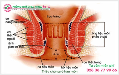 Vậy mổ rò hậu môn ở đâu tốt  tại TP.HCM là một vấn đề nhận được nhiều sự quan tâm.