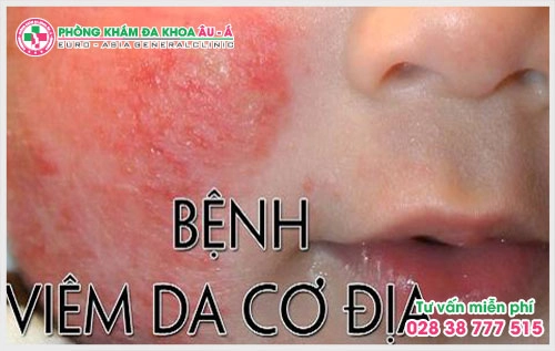 Dấu hiệu của bệnh da liễu thường bộc lộ hẳn ra ngoài và người bệnh có thể nhận biết bằng mắt thường.