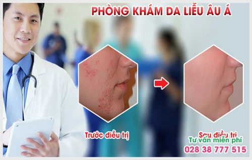 Số điện thoại bệnh viện da liễu tại Phòng Khám Đa Khoa Âu Á sẽ giúp người bệnh có thể giải đáp mọi thắc mắc của mình không chỉ với các bệnh lý về da mà còn với tất cả các bệnh ngoại khoa nam, phụ khoa, bệnh xã hội khác.