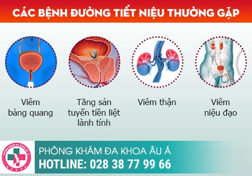 hình ảnh bệnh nam khoa