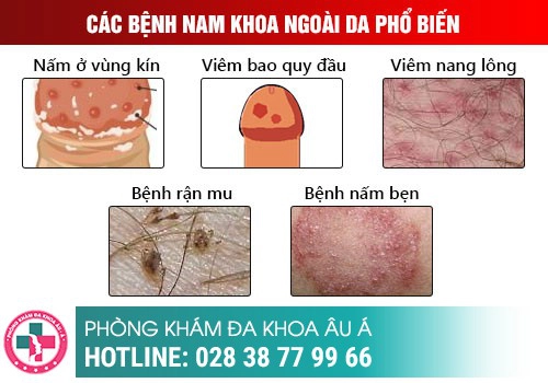 Khi nào cần đi khám nam khoa?