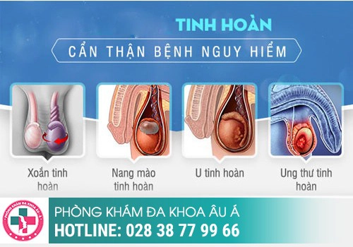 hình ảnh bệnh nam khoa