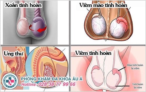 bệnh tinh hoàn