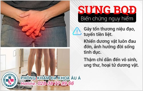 Sưng bao quy đầu là bị bệnh gì? Có nguy hiểm không?