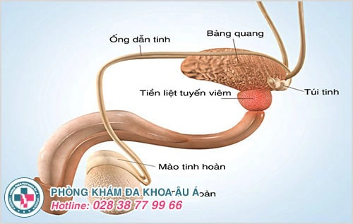 Viêm tuyến tiền liệt và những nguy hại khôn lường