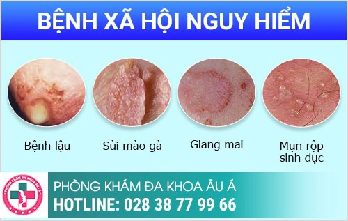 Các bệnh ngoại khoa nam Thường Gặp