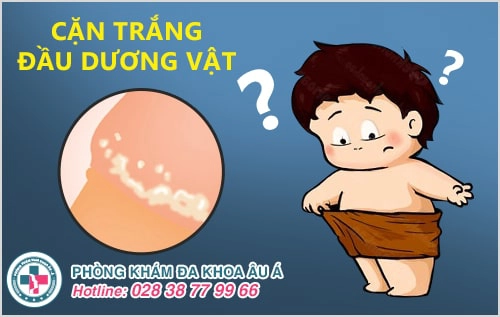 Phát hiện cặn trắng đầu dương vật khiến nam giới sửng sốt