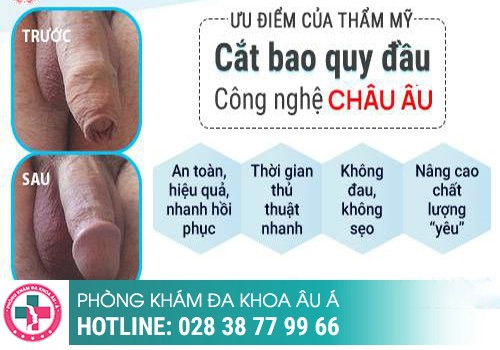 Địa chỉ cắt bao quy đầu Quận 2 uy tín