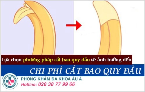 chi phí cắt bao quy đầu