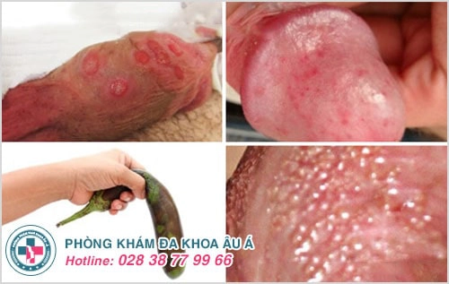 chữa yếu sinh lý tại nhà