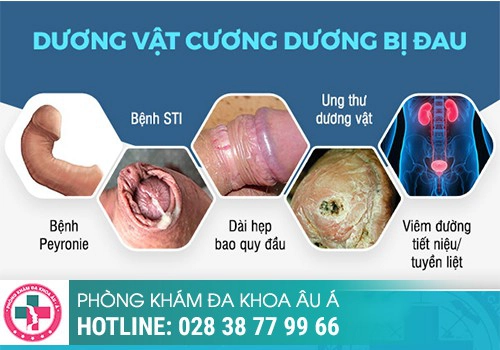 Dương vật cương cứng bị đau là gì?