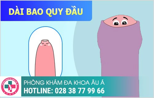 Dài bao quy đầu