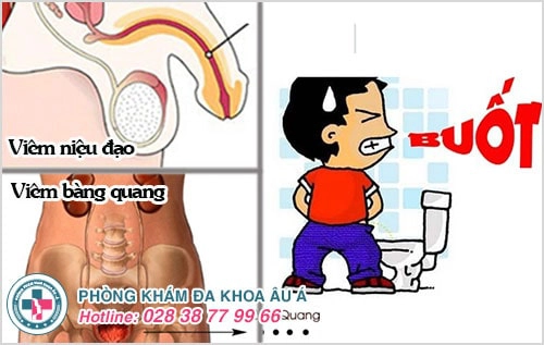 đái buốt ở nam