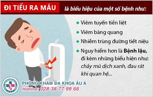 Tiểu ra máu là mắc bệnh gì? Giải đáp chi tiết từ bác sĩ chuyên khoa