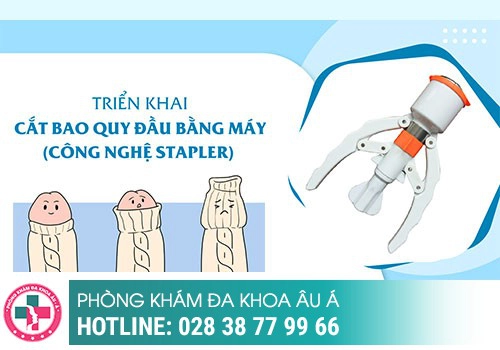 Những lợi ích khi cắt bao quy đầu 