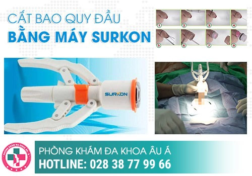 Cắt bao quy đầu quận 12