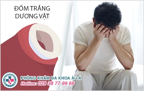 Đốm trắng dương vật là bệnh gì? Có nguy hiểm không?