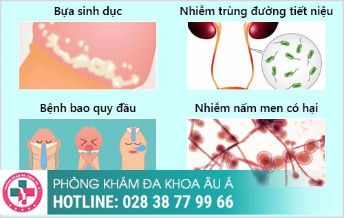 dương vật bị hôi