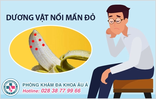 Nổi mẩn đỏ dương vật