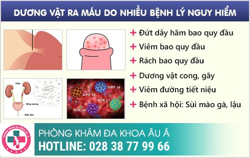 Dương vật ra máu