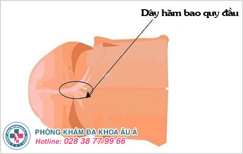 đứt dây hãm bao quy đầu