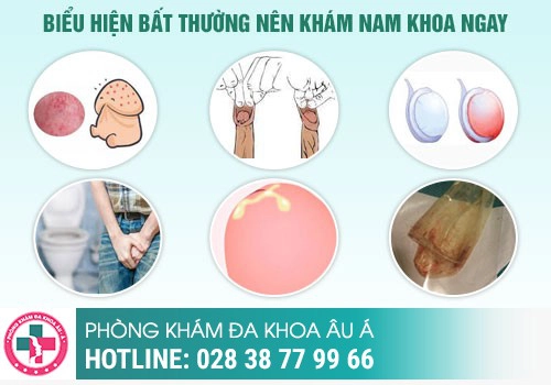 Khi nào cần đi khám nam khoa?