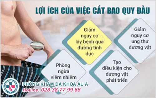 Những lợi ích cắt bao quy đầu đối với sức khỏe nam giới