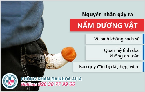 Bệnh nấm dương vật là gì?