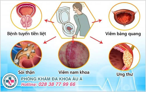 Đi giải ra máu ở nam và nữ cảnh báo điều gì? Có nguy hiểm không?