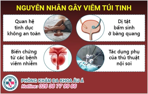 Bệnh viêm túi tinh và những điều cần biết