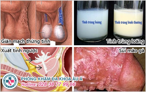 Vô sinh hiếm muộn, nguyên nhân do đâu?