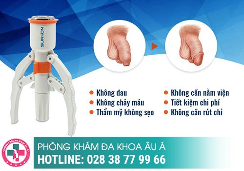 Phương pháp cắt bao quy đầu tiên tiến hiện nay