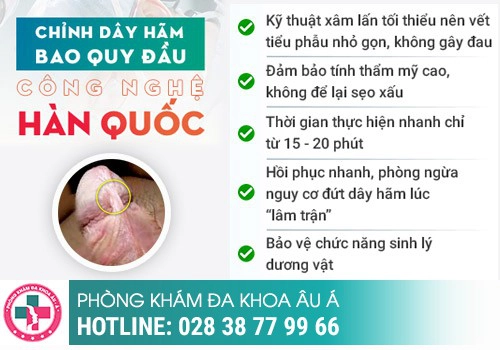 Chữa đứt dây hãm bao quy đầu? Chữa ở đâu?