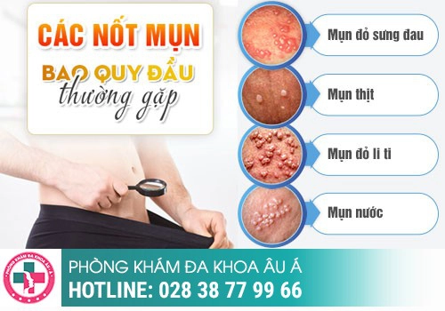 Lở loét vùng kín nam giới là bị gì?