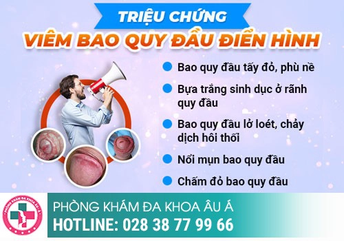 Triệu chứng nhận biết viêm bao quy đầu