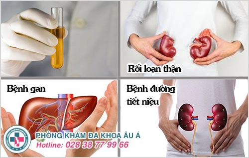 Nước tiểu có màu lạ