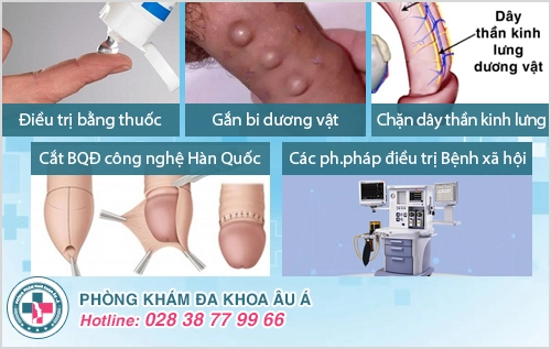 Khám vùng kín nam ở đâu tốt tại TP.HCM?