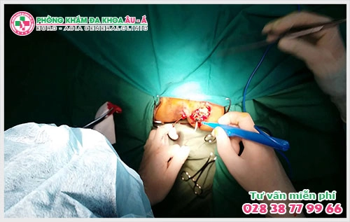 Đa Khoa Âu Á là một trong những địa chỉ y tế uy tín  tại TPHCM đã và đang áp dụng phương pháp chữa trị bệnh rò hậu môn chảy mủ hiệu quả  hiện nay đó là HCPT và PPH.