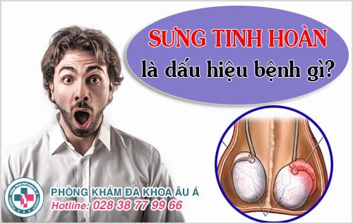 sưng tinh hoàn
