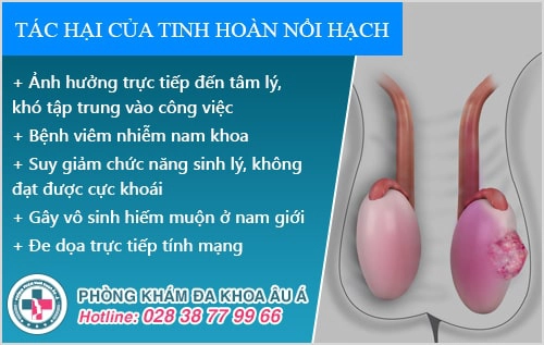 Tinh hoàn nổi hạch là bệnh gì? Có nguy hiểm không?