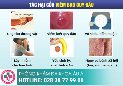 Đau buốt vùng kín nam nguyên nhân do đâu?