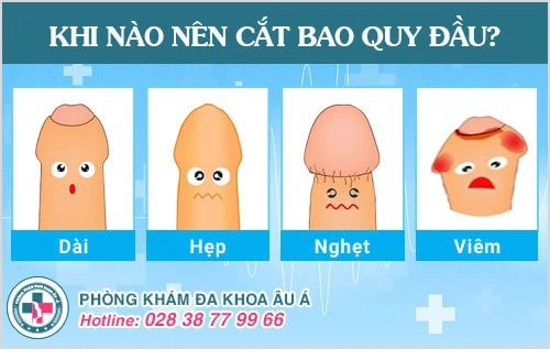 tại sao phải cắt bao quy đầu