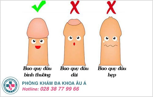 Có thuốc chữa xuất tinh sớm hiệu quả không?