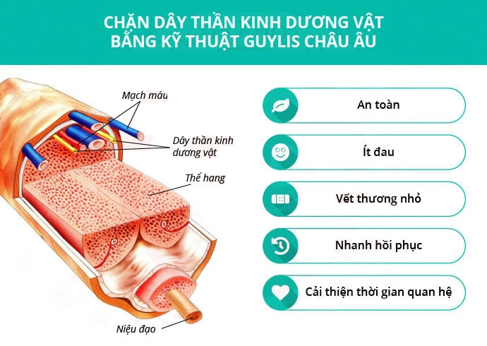 Có thuốc chữa xuất tinh sớm hiệu quả không?