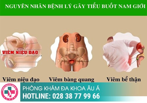 Nguyên nhân gây đau rát khi đi tiểu nam giới là gì?