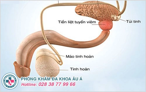 tinh trùng đặc tinh trùng vón cục